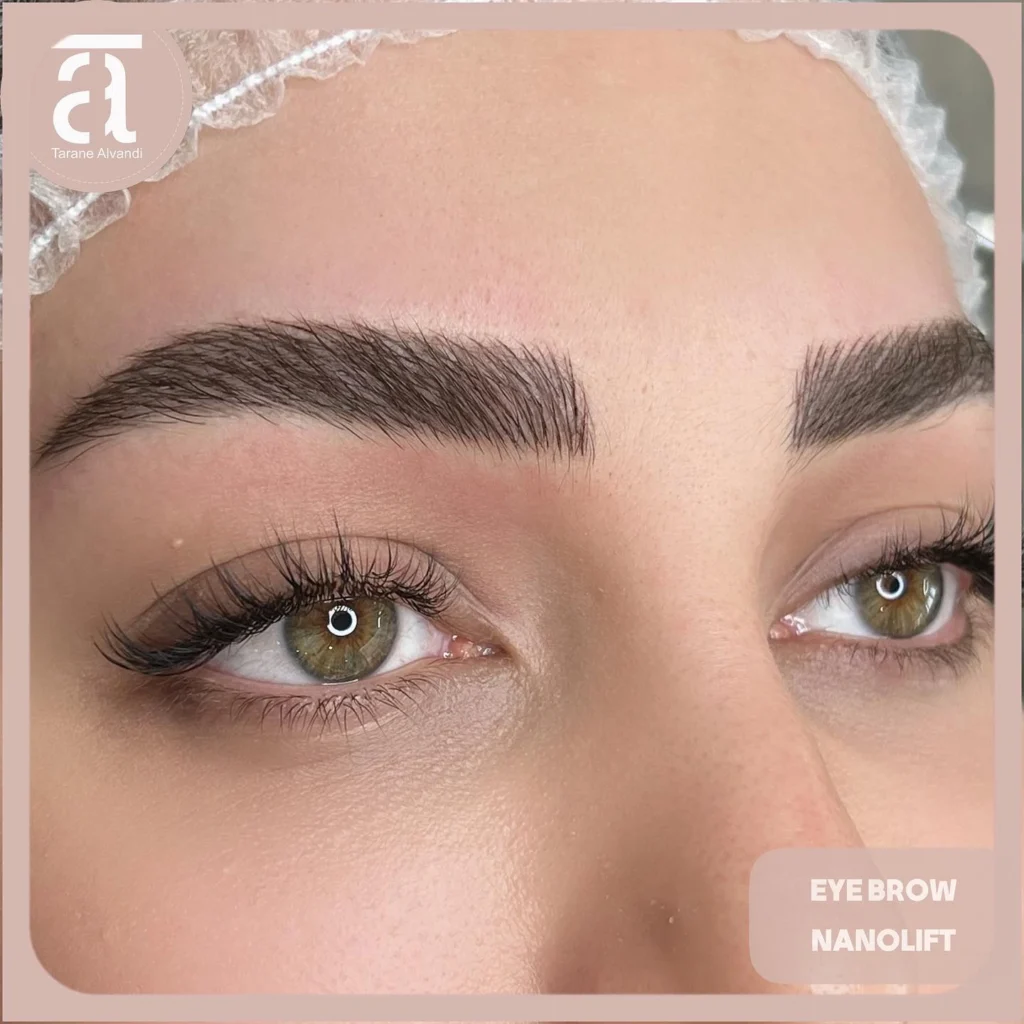 چند روز بعد از میکروبلیدینگ میتوان صورت را شست؟  پاسخ کوتاه این است که معمولا بین ۷ تا ۱۰ روز بعد از انجام میکروبلیدینگ، زمانی است که شما می‌توانید شستشوی کامل صورت را آغاز کنید؛ ولی این بازه برای همه یکسان نیست.