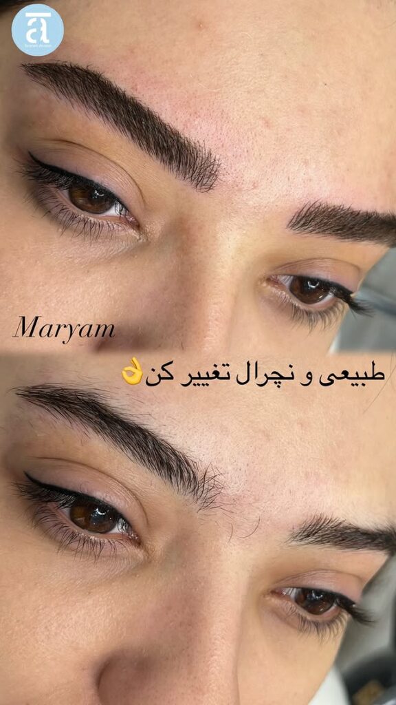 آشنایی با مراحل ترمیم ابرو بعد از میکروبلیدینگ