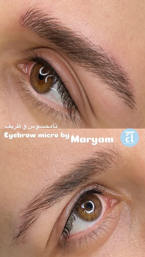 مراحل ترمیم ابرو بعد از میکروبلیدینگ
