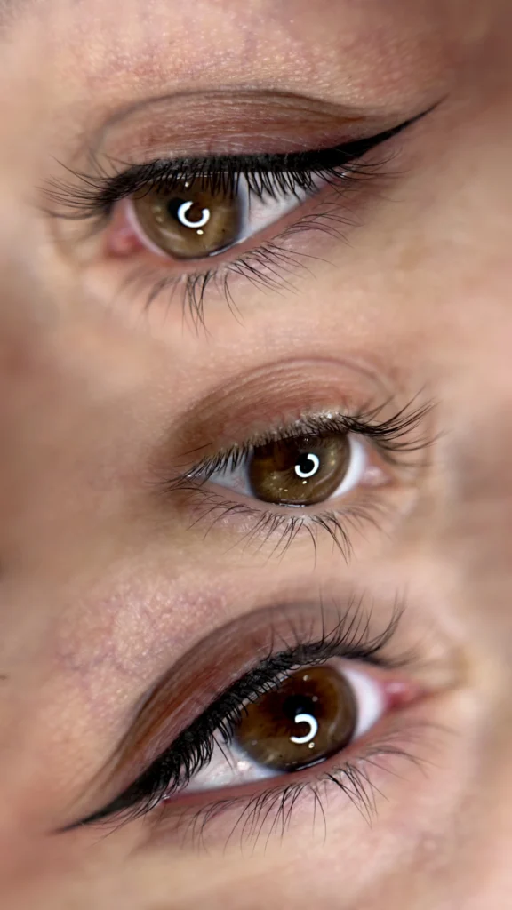 انواع عوارض بن مژه