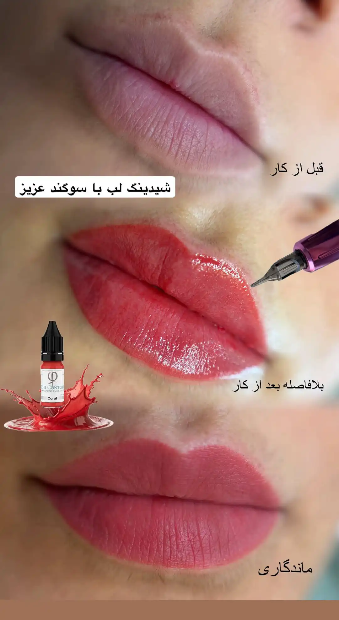 عکس قبل و بعد همراه با عکس ماندگاری شیدینگ لب