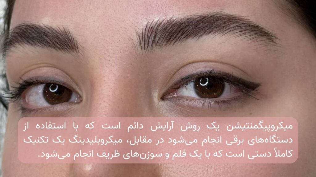 تفاوت میکروبلیدینگ و میکروپیگمنتیشن: میکروپیگمنتیشن یک روش آرایش دائم است که با استفاده از دستگاه‌های برقی انجام می‌شود در مقابل، میکروبلیدینگ یک تکنیک کاملاً دستی است که با یک قلم و سوزن‌های ظریف انجام می‌شود. 