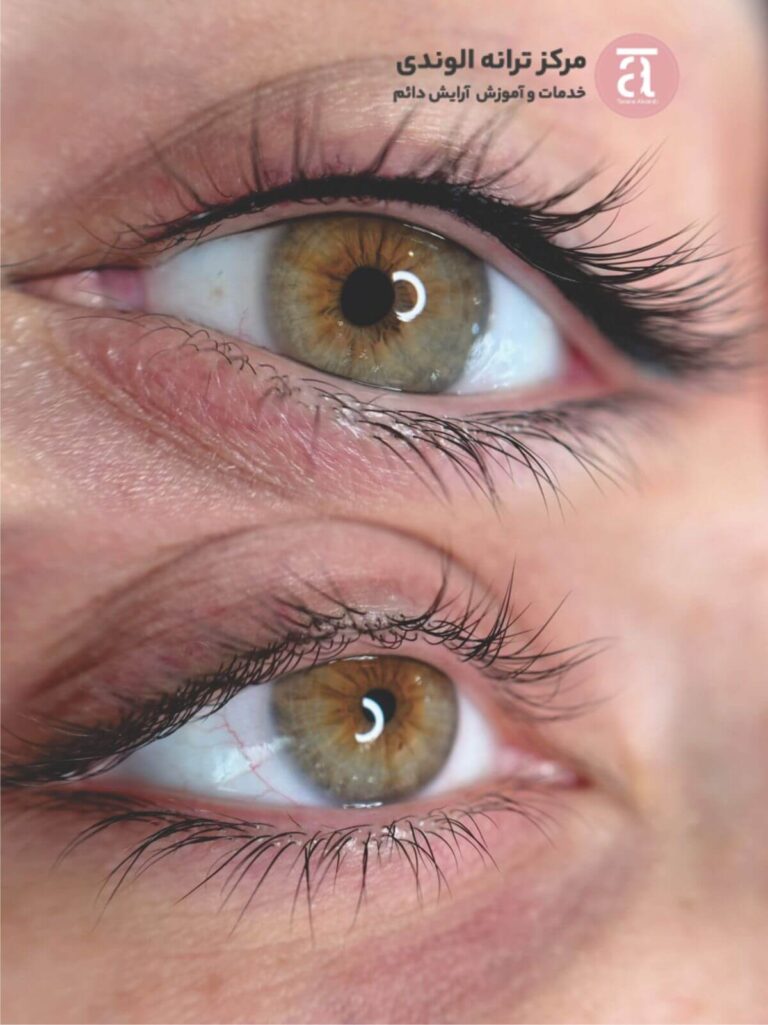 آموزش بن مژه در آکادمی ترانه الوندی