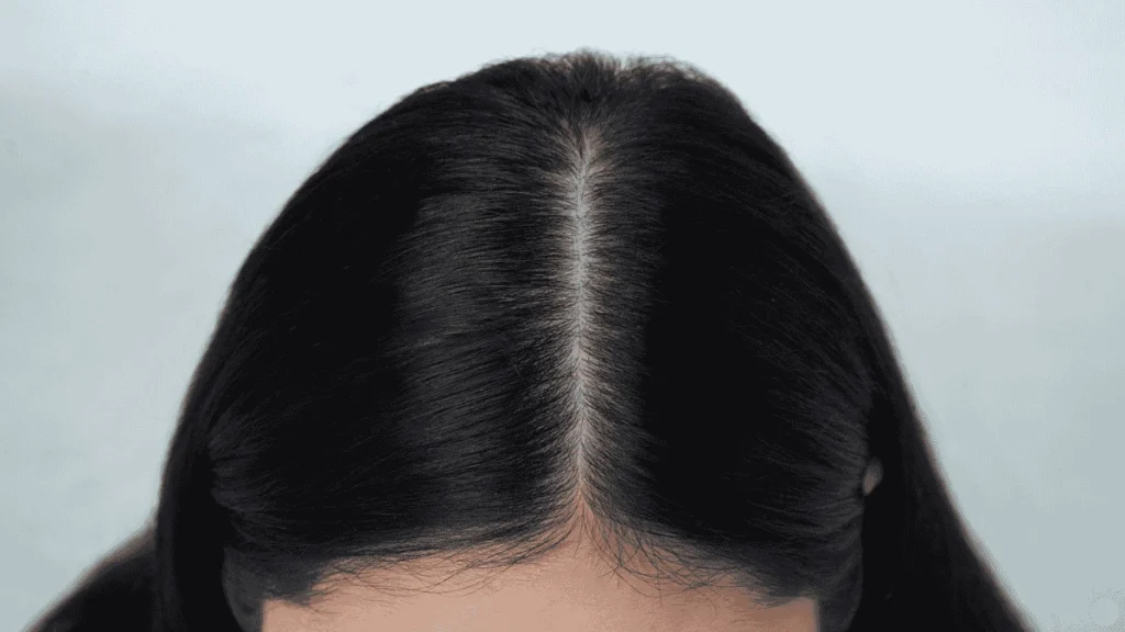 آیا اسکالپ سر باعث ریزش مو میشود؟