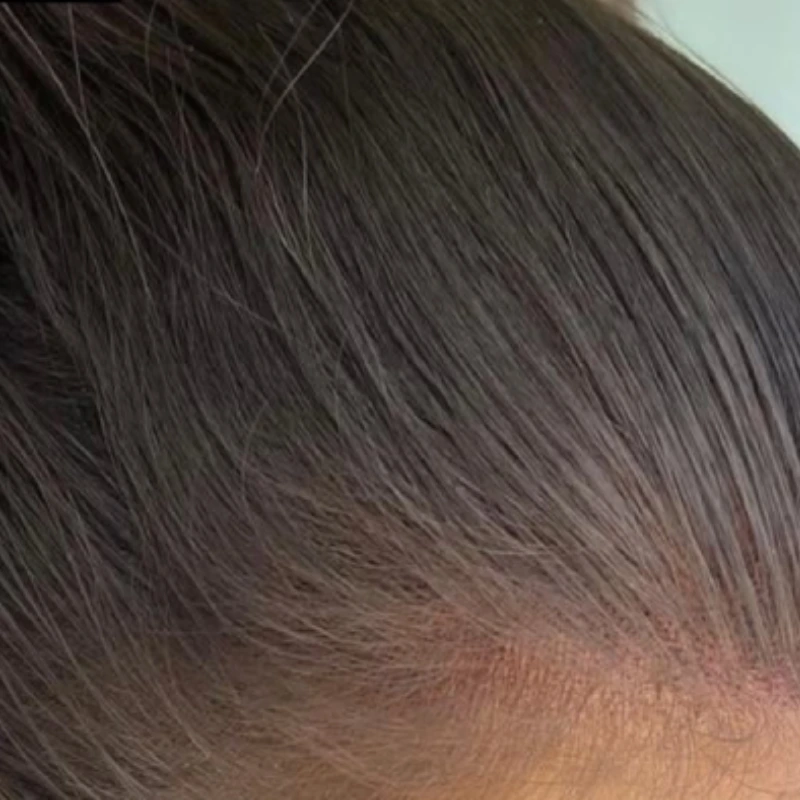 هزینه اسکالپ سر