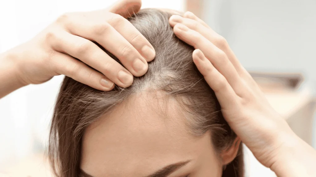 آیا اسکالپ واقعا باعث ریزش مو میشود؟