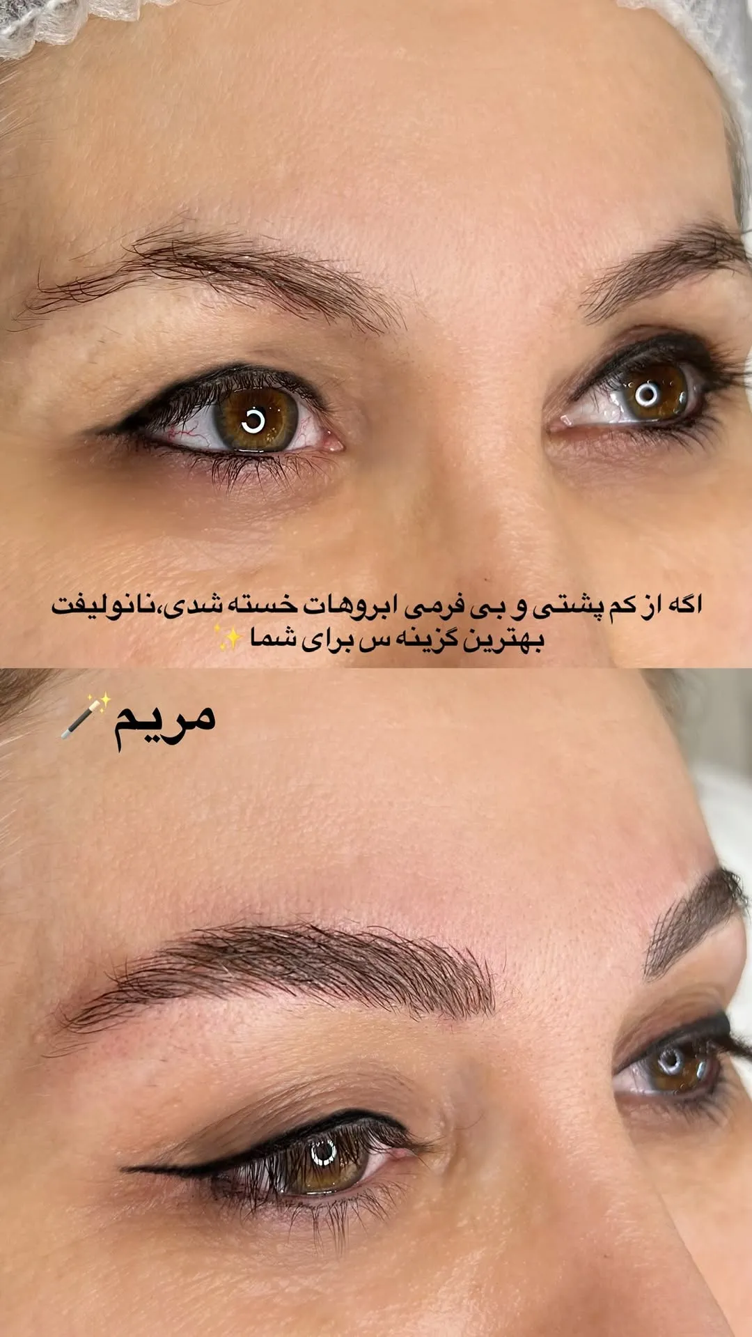 عکس میکروی ابرو