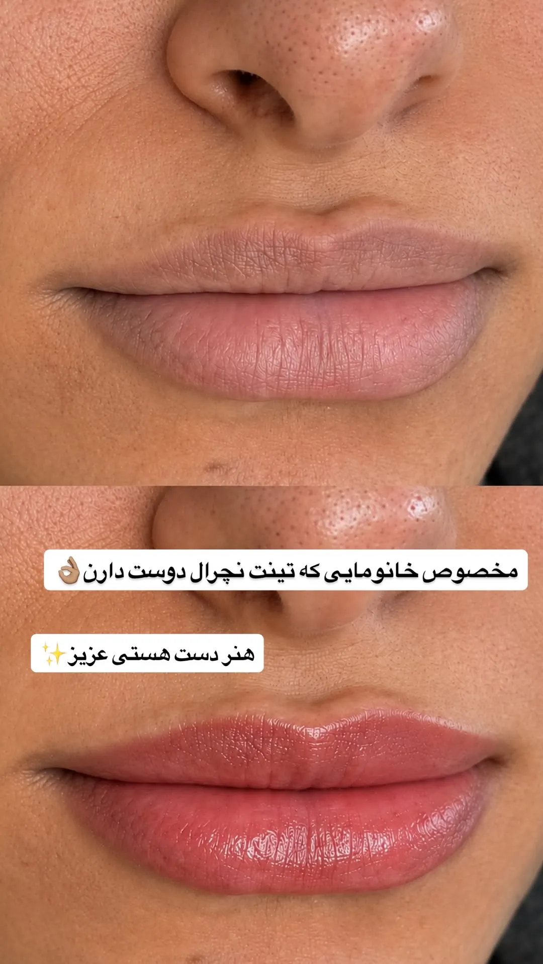 عکس قبل و بعد تینت لب نچرال هنر دست مستر هستی در مرکز زیبایی ترانه الوندی