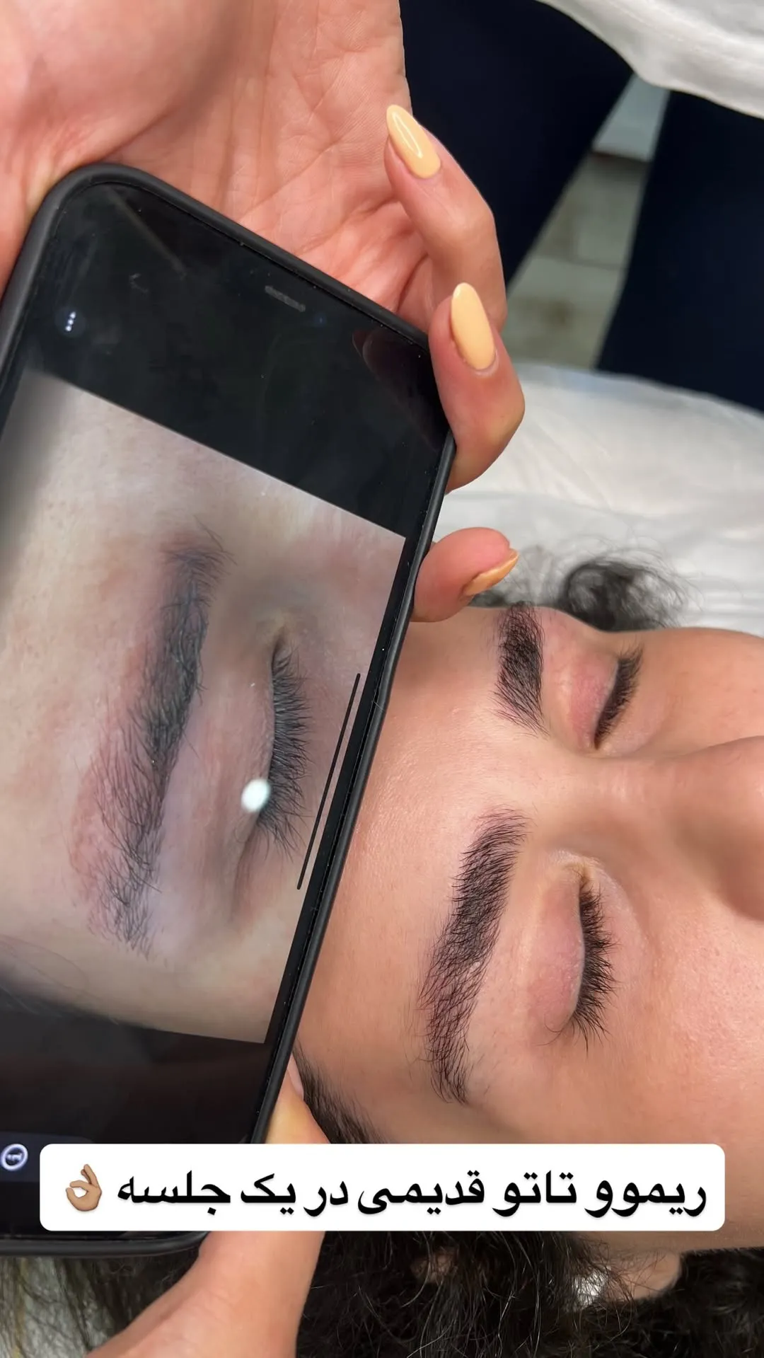عکس بعد از ریموو ابرو در مرکز ترانه الوندی