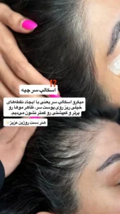 اسکالپ سر چیست و چگونه انجام میشود؟