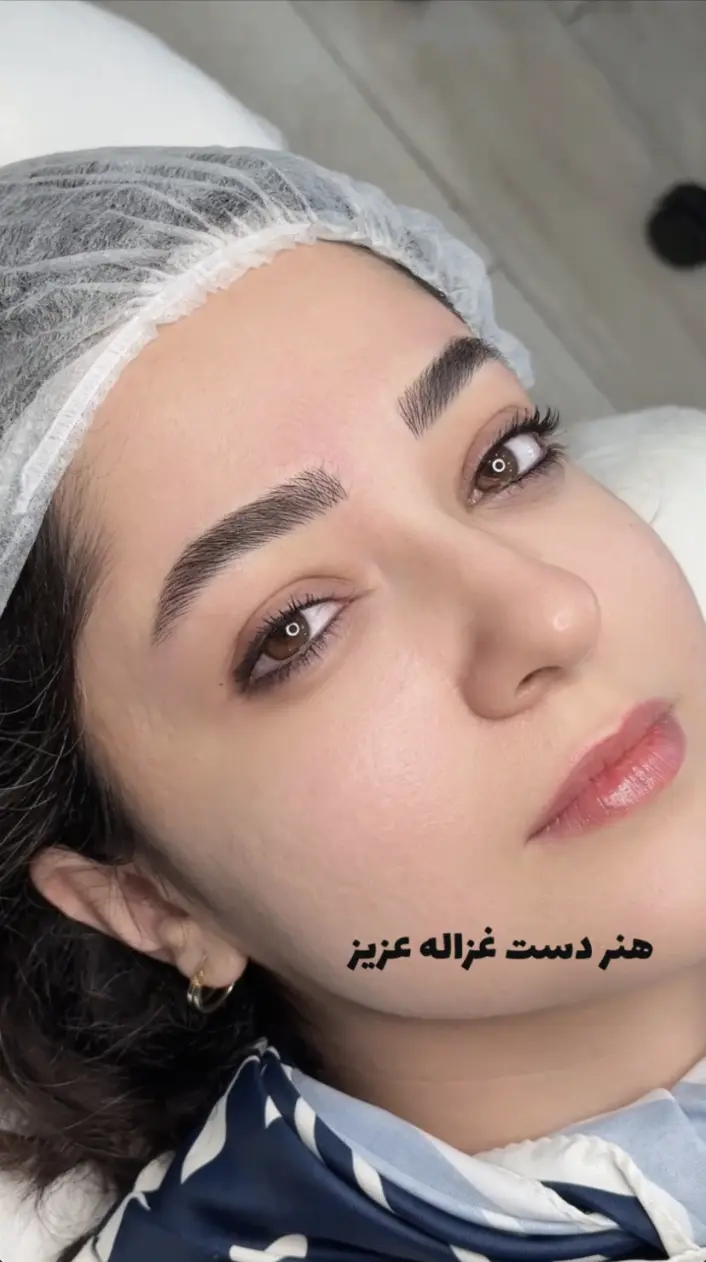 یکی از تصاویر میکرو ابرو کلینیک زیبایی ترانه الوندی