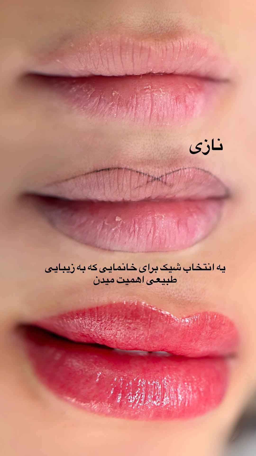 عکس قبل و بعد شیدینگ لب رنگ قرمز