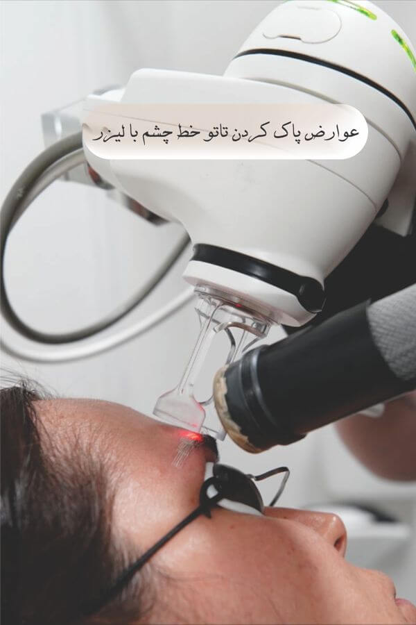 عوارض پاک کردن تاتو خط چشم با لیزر